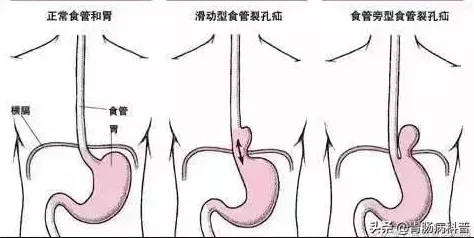 堵住尿孔不能尿按肚子知乎:探讨在特定情况下,如何通过物理方法缓解排尿困难的经验与建议 堵住尿孔不能尿按肚子知乎:探讨在特定情况下,如何通过物理方法缓解排尿困难的经验与建议