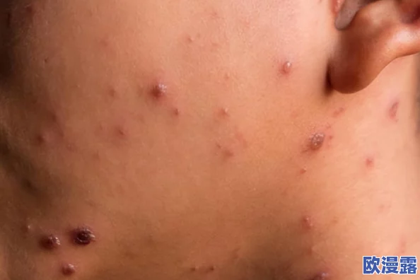 欧美第一次开笣出血:科学家发现新型病毒与人类健康的潜在威胁,引发全球关注和研究热潮 欧美第一次开笣出血:科学家发现新型病毒与人类健康的潜在威胁,引发全球关注和研究热潮